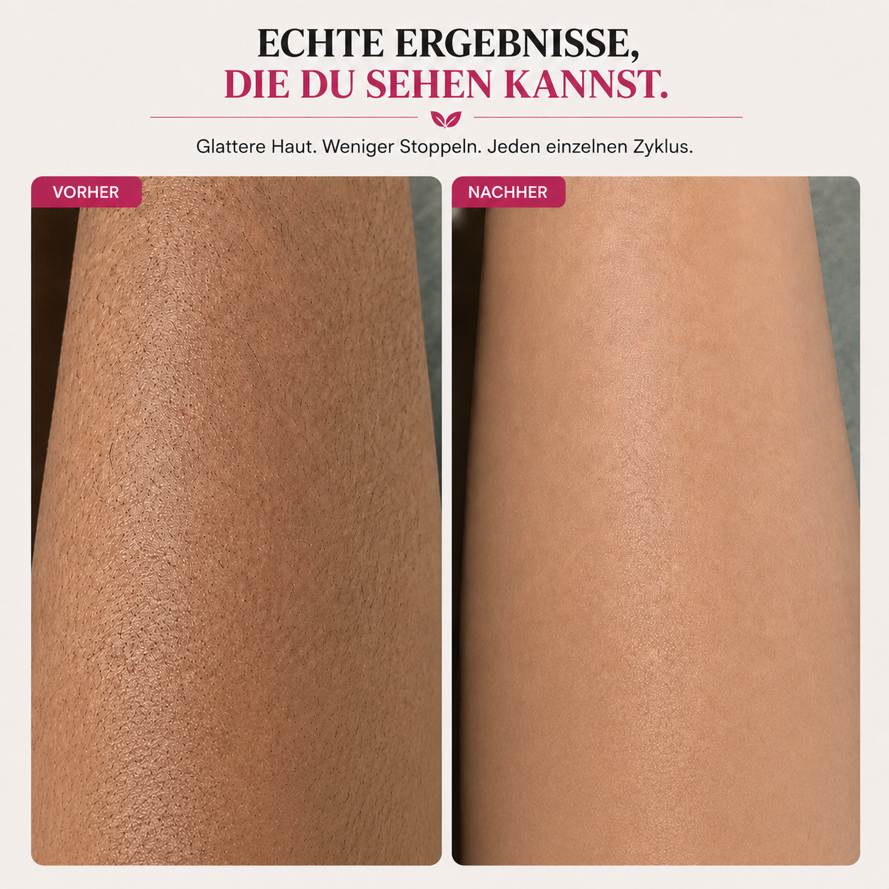 Anti-Haarwuchs Öl