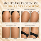 Loresia Gold Anti-Cellulite Gel