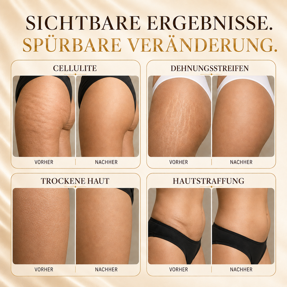 Loresia Gold Anti-Cellulite Gel